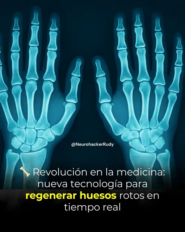 🦴 Révolution dans la médecine : une nouvelle technologie pour régénérer les os fracturés en temps réel